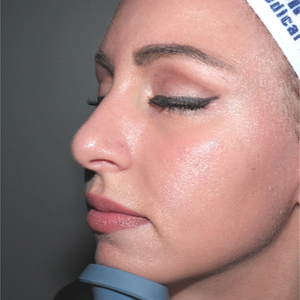 Larson Medical Aesthetics University Place University Place Washington Realself