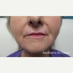 Aesthetics By Eileen Laser Skin Care Medical Spa Raleigh Raleigh North Carolina Realself