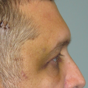 Nicholas Tarola Md Reviews Before And After Photos Answers Realself