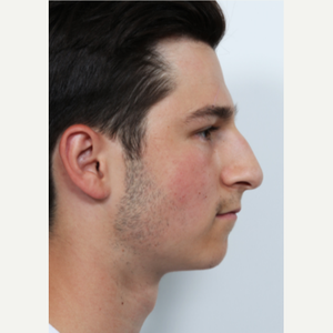 David B Rosenberg Md Reviews Before And After Photos Answers Realself