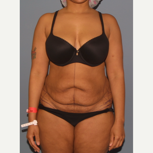 Adam Tattelbaum Md Reviews Before And After Photos Answers Realself