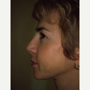Leonard Grossman Md Reviews Before And After Photos Answers Realself