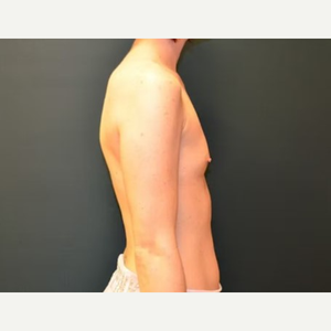 Lewis Albert Andres, MD Reviews, Before and After Photos, Answers - RealSelf