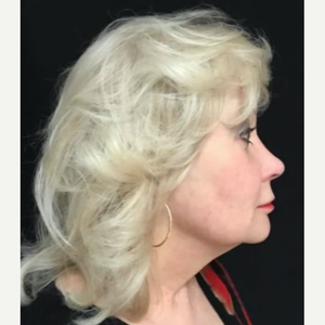 Michele S Green Md Reviews Before And After Photos Answers Realself Michele s green, md is a doctor primarily located in new york, ny. michele s green md reviews before