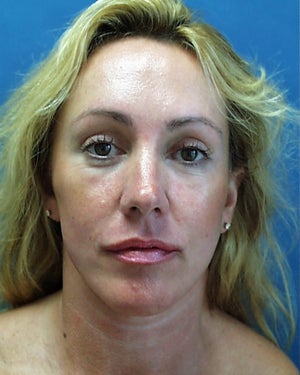 Kurtis Martin Md Reviews Before And After Photos Answers Realself