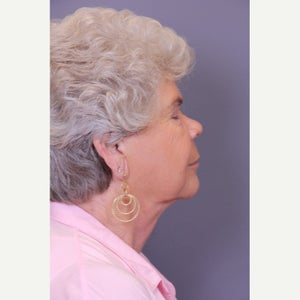 Sonny O Md Reviews Before And After Photos Answers Realself