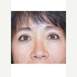 Umeng David Thao Md Reviews Before And After Photos Answers Realself