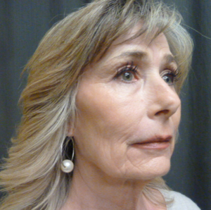 Warren Schutte Md Reviews Before And After Photos Answers