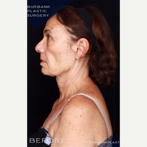 George Orloff Md Facs Reviews Before And After Photos Answers Realself