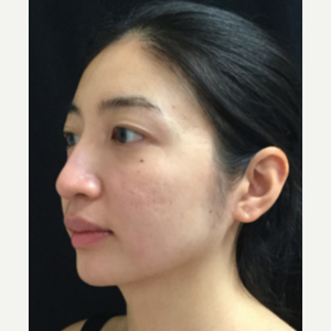 Michele S Green Md Reviews Before And After Photos Answers Realself You can call at +1 212 535 3088 or find more contact information. michele s green md reviews before