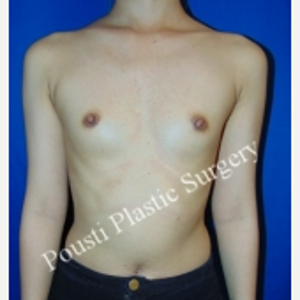 Tom J Pousti Md Reviews Before And After Photos Answers Realself