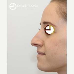 Eddy Dona Mbbs Fracs Reviews Before And After Photos Answers Realself