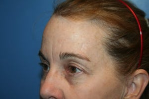 Tanya Aya Atagi Md Reviews Before And After Photos Answers Realself