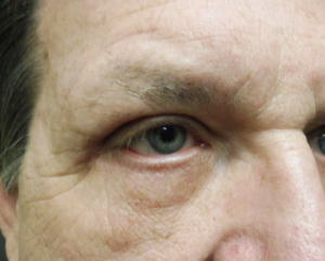 Warren Schutte Md Reviews Before And After Photos Answers