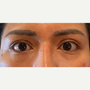 Ann Jayaram Md Reviews Before And After Photos Answers Realself Be sure to call ahead with dr. ann jayaram md reviews before and