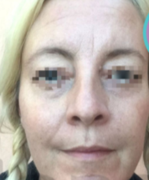 Fuat Yuksel Md Reviews Before And After Photos Answers Realself