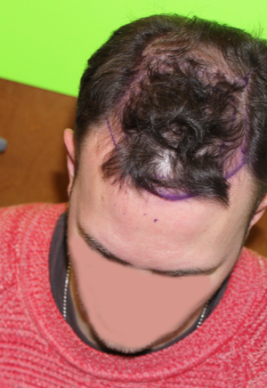 Blake Bloxham Md Reviews Before And After Photos Answers Realself