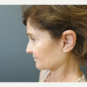 Pedy Ganchi Md Reviews Before And After Photos Answers Realself