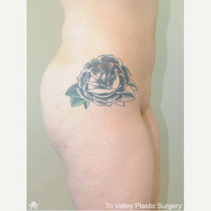 Steven H Williams Md Reviews Before And After Photos Answers Realself