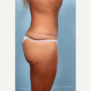 Gene Sloan, MD Reviews, Before and After Photos, Answers - RealSelf