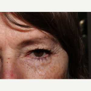 Lawrence Kass Md Reviews Before And After Photos Answers Realself