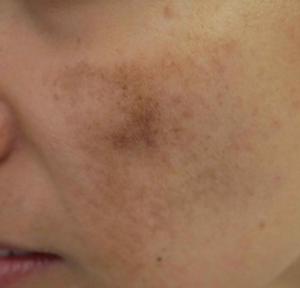Davin Lim Mbbs Facd Reviews Before And After Photos Answers Realself
