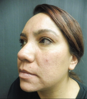 Warren Schutte Md Reviews Before And After Photos Answers