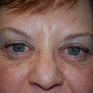 Steven Yarinsky Md Facs Reviews Before And After Photos Answers Realself