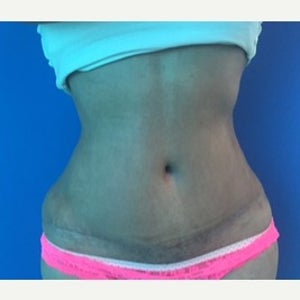 Orlando Llorente, MD Reviews, Before and After Photos, Answers
