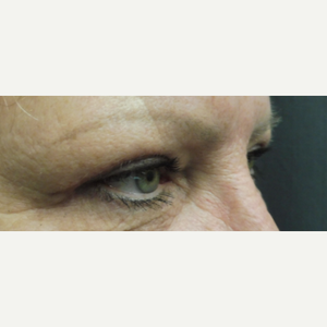 Warren Schutte Md Reviews Before And After Photos Answers