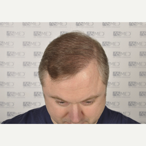 Koray Erdogan Md Reviews Before And After Photos Answers Realself
