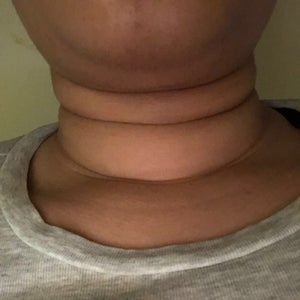 Neck with sale rolls