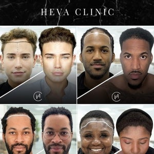 Heva Clinic - Istanbul