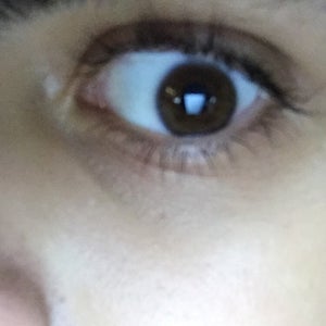 wrinkles under eyes at 15