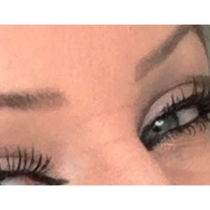 horizontal crease between eyes