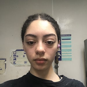does vaping puff your face Does Vaping Cause Acne?