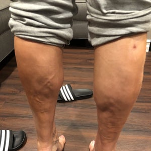 That's it. I'm having calf reduction surgery…🫠 : r/lululemon