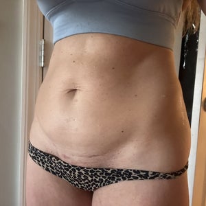 lipo c capsules Liposomal Vitamin C