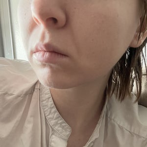 before and after
