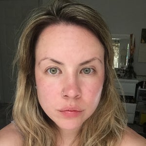 static wrinkles under eyes