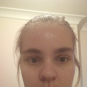 Surgery to make outlet eyes look asian