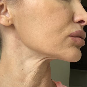 before and after
