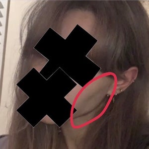before and after