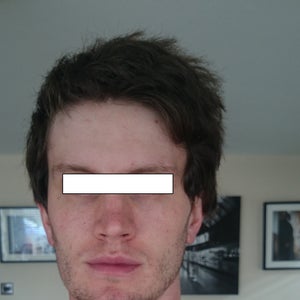 long face syndrome profile