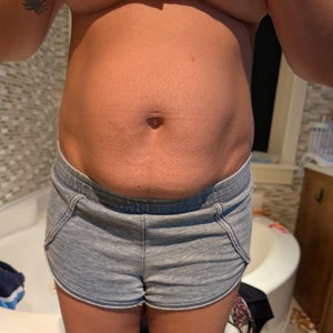 37, 2 C-sections