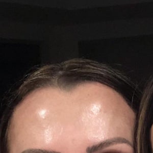 Ofg7jdycslgmrm Or download a standalone windows executable from github releases. https www realself com reviews septoplasty