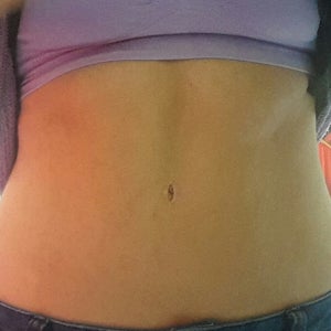 belly button piercing after tummy tuck