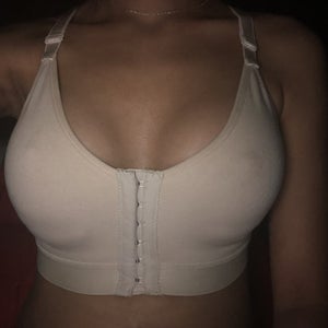 One boob higher and harder than the other. I'm 3.5 weeks post op