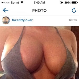 Saggy 36B looking to be a small lifted D. (photo)