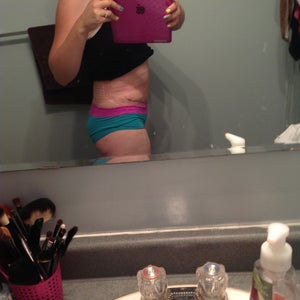 Can You Wear a Binder on Top of Spanx After a Tummy Tuck? (photo)
